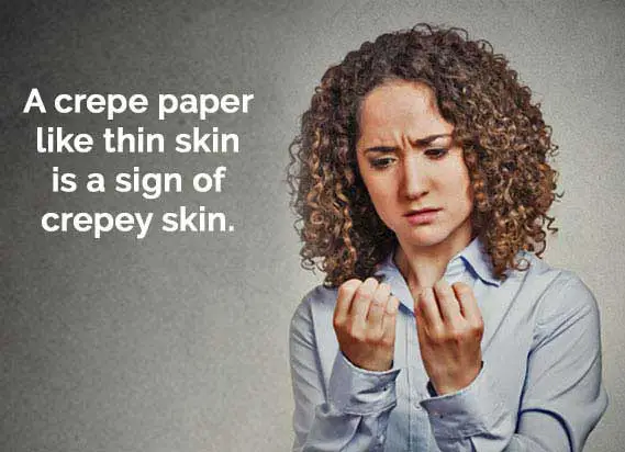 crepey skin hand=